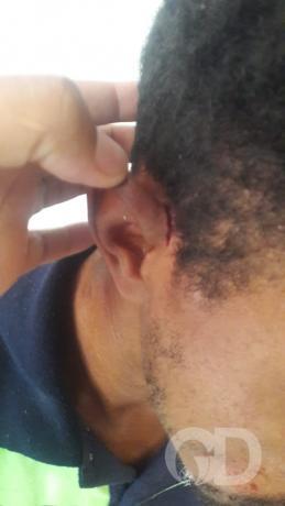 morador orelha arrancada jonas pinheiro