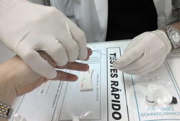 Teste r&aacute;pido HIV