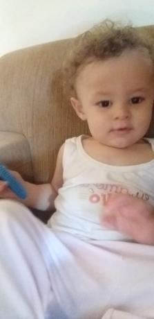 Nickolas Souza Valério  queimado