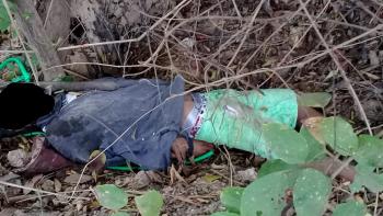 corpo saco na cabeça