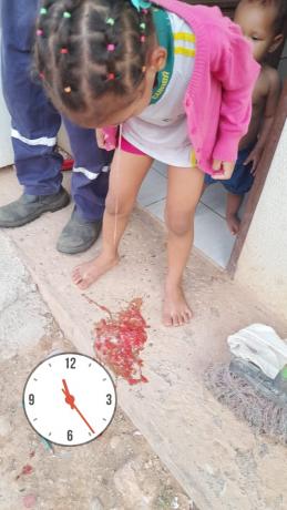 menina queda vomita escola