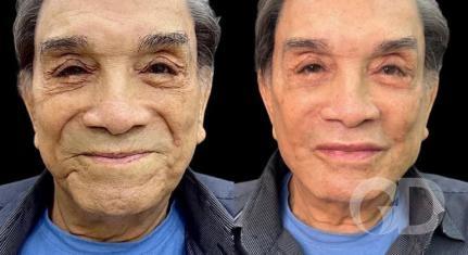 Reprodução/Instagram