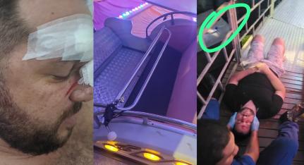 Reprodução