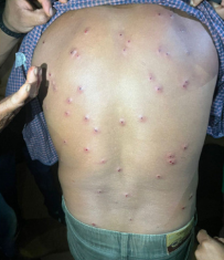 Ind&iacute;gena atacado 