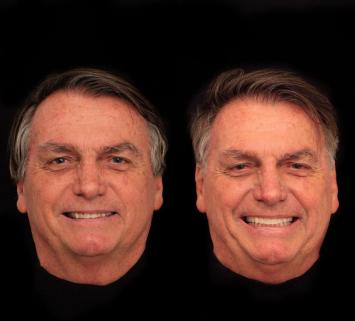 bolsonaro antes e depois