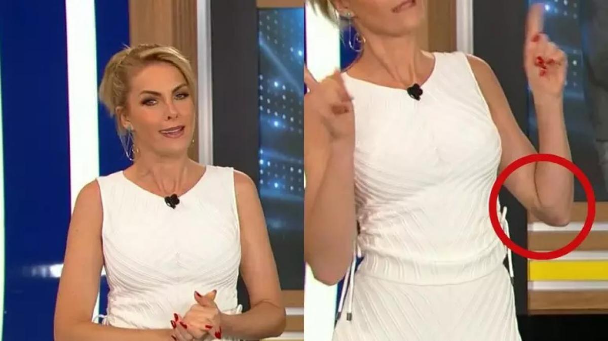 Ana Hickmann apresenta 'Hoje em Dia' com vestido que mostra hematoma no braço | Gazeta Digital
