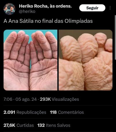 Ana sátila meme