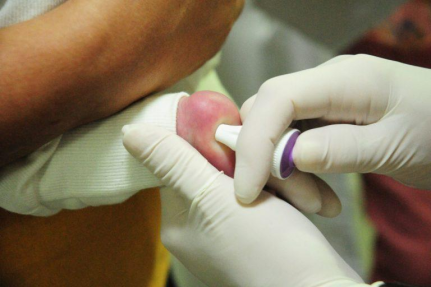 Breno Esaki/Agência Saúde-DF