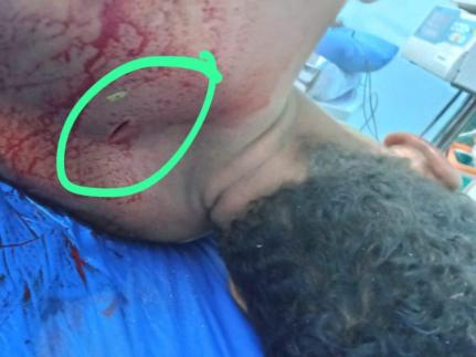 Reprodução TV Centro Oeste