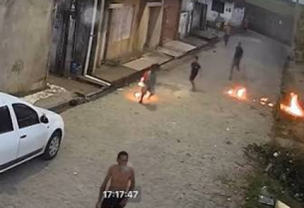 criança queimada